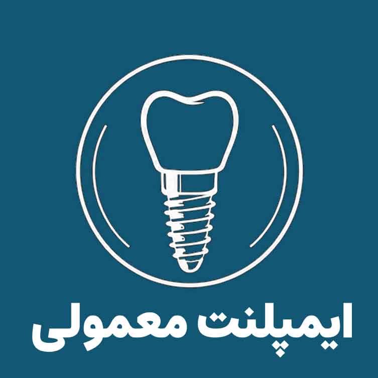ایمپلنت معمولی در کلینیک تخصصی ایمپلنت و دندانپزشکی رز - دکتر علیرضا رجبی متخصص ایمپلنت و پروتز های دندانی