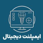 ایمپلنت دیجیتال در کلینیک تخصصی ایمپلنت و دندانپزشکی رز - دکتر علیرضا رجبی متخصص ایمپلنت و پروتز های دندانی