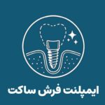 ایمپلنت فرش ساکت در کلینیک تخصصی ایمپلنت و دندانپزشکی رز - دکتر علیرضا رجبی متخصص ایمپلنت و پروتز های دندانی