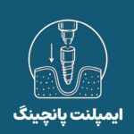 ایمپلنت پانچینگ در کلینیک تخصصی ایمپلنت و دندانپزشکی رز - دکتر علیرضا رجبی متخصص ایمپلنت و پروتز های دندانی