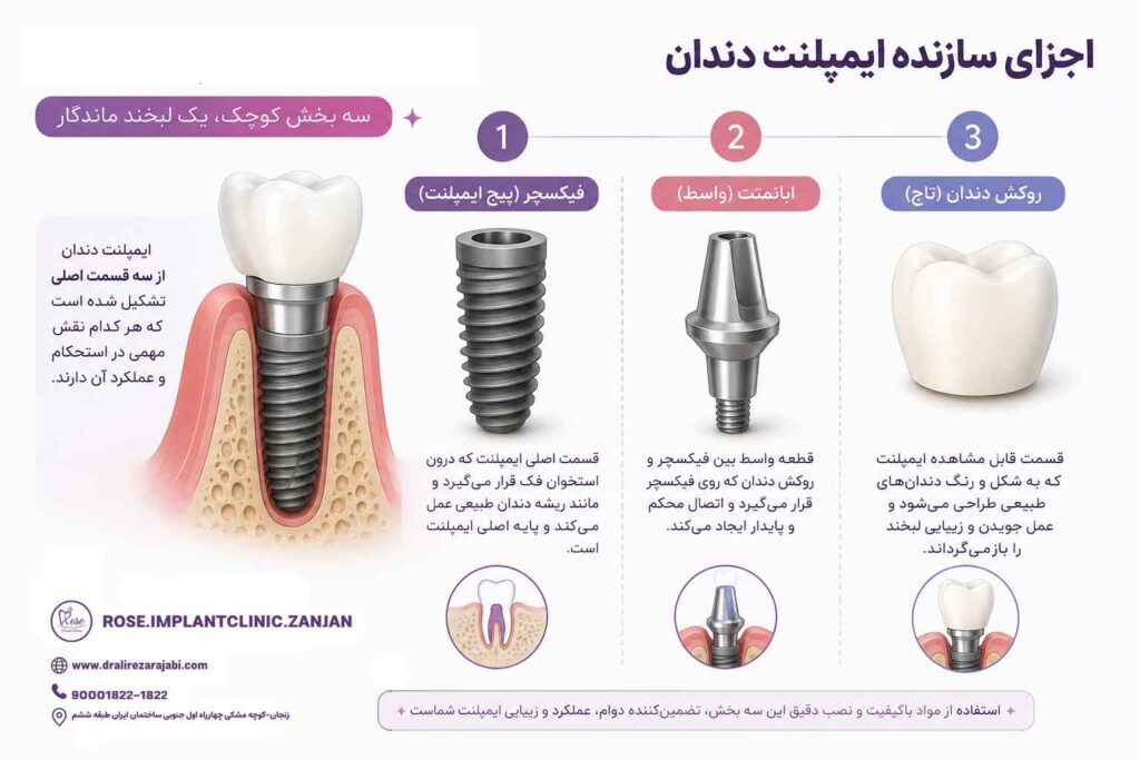 اینفوگرافیک احزای-تشکیل-دهنده-ایمپلنت--دکتر-علیرضا-رجبی-متخصص-ایمپلنت---کلینیک-ایمپلنت-و-دندانپزشکی-رز-زنجان