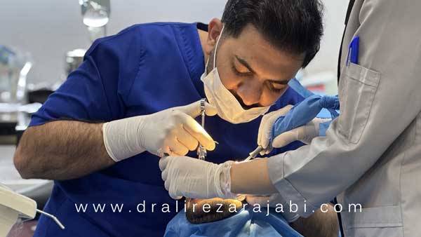دکتر علیرضا رجبی متخصص ایمپلنت در زنجان