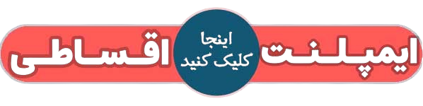 دکمه ایمپلنت اقساطی