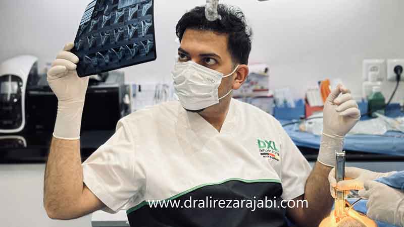 دکتر علیرضا رجبی ایمپلنت فوری