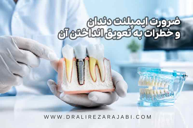 ضرورت ایمپلنت دندان و خطرات به تعویق انداختن آن | راهنمای کامل