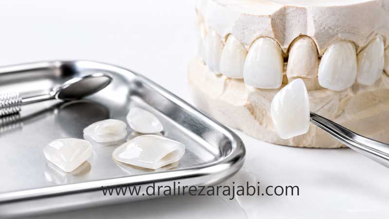 کامپوزیت در کلینیک دندانپزشکی رز زنجان